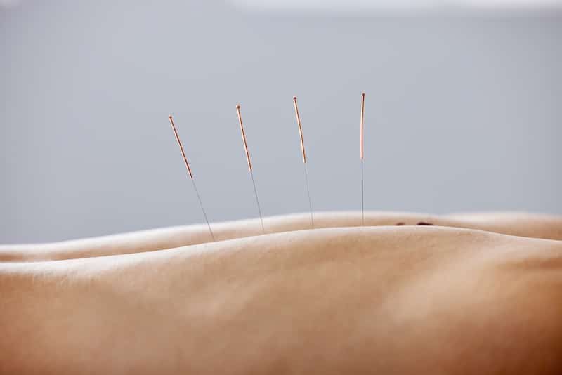 Acupuncture in Felton, MN